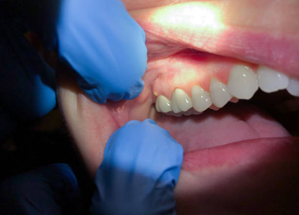 Best Emergency Dental Care for Sports Injuries in Geva, NE
